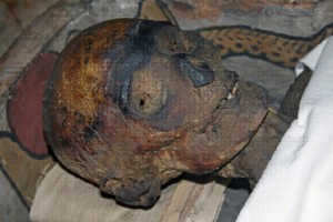 En 1968, el miembro de Tutankamón no aparecía en las imágenes de rayos X